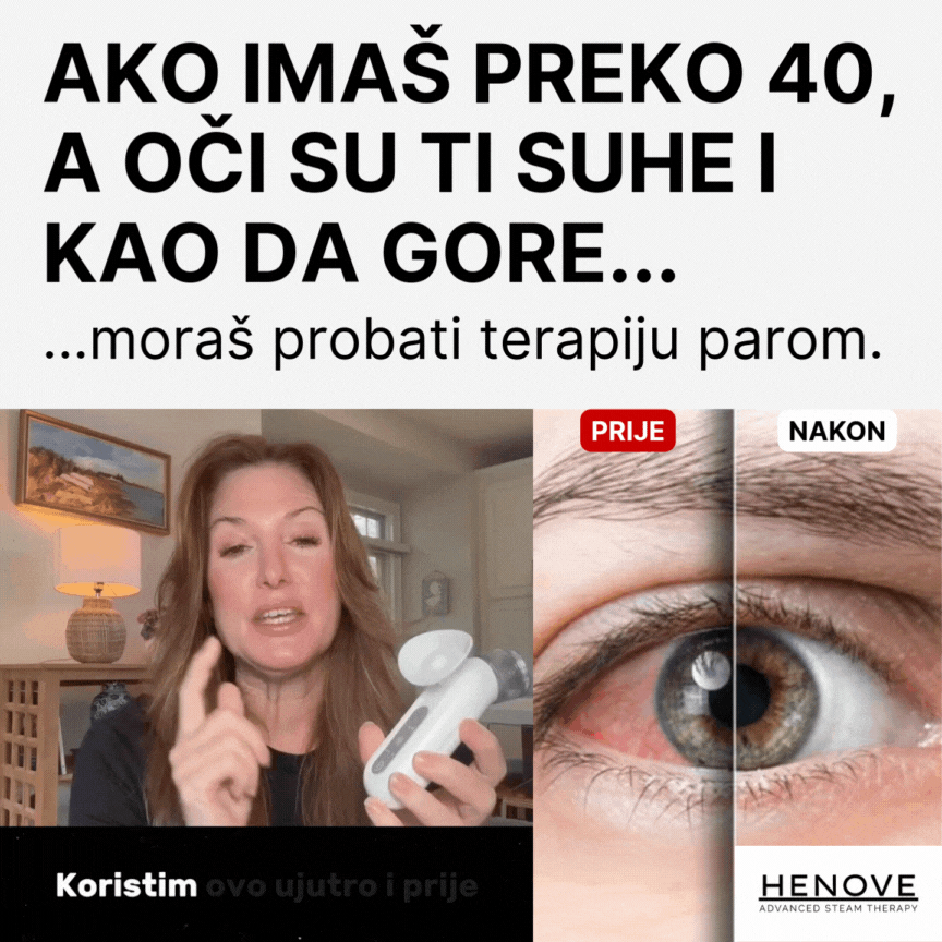 OcuSteam™ - Terapija parom